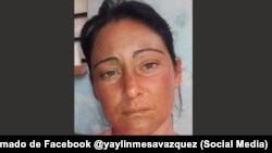 Yaylin Mesa Vázquez.