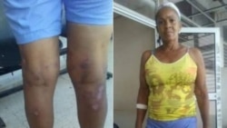 Dama de Blanco reportada grave por médicos de terapia intermedia Dama de Blanco reportada grave por médicos de terapia intermedia