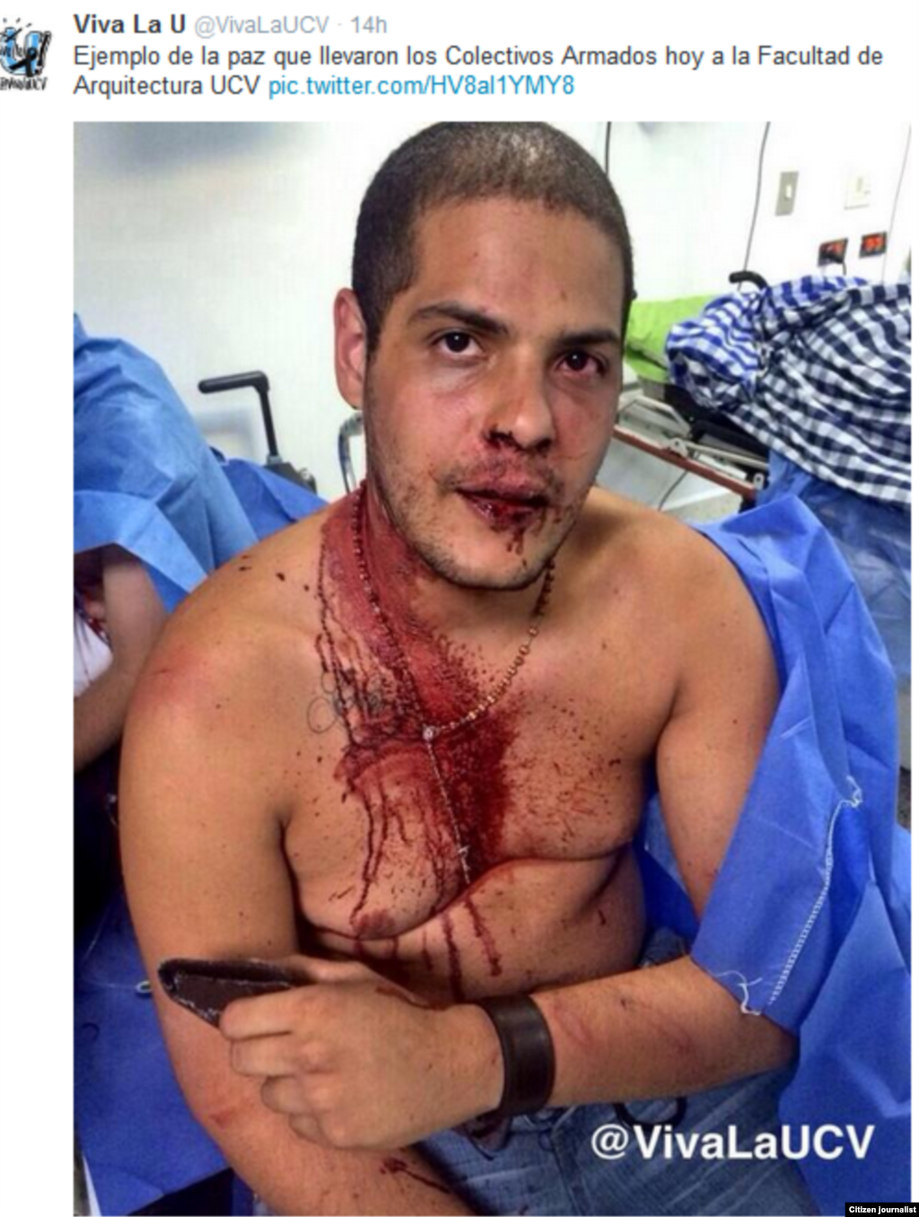 Seis estudiantes agredidos fueron ingresados al Hospital Clínico Universitario.UCV.