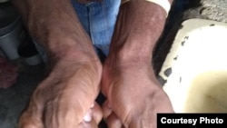 Cantillo muestra la marca de las esposas.