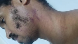 Liberados los artistas Luis Manuel Otero Alcántara y Maykel Osorbo Liberados los artistas Luis Manuel Otero Alcántara y Maykel Osorbo